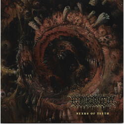 Hyperdontia (2) Nexus Of Teeth