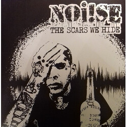 Noi!se The Scars We Hide