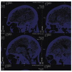 The Nightingales Mind Over Matter