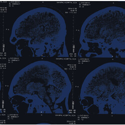 Nightingales Mind Over Matter Vinyl LP