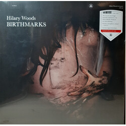 Hilary Woods Birthmarks