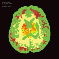 The Minus 5 Stroke Manor Vinyl LP