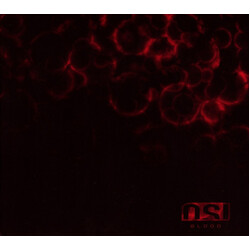 OSI Blood Vinyl 2 LP