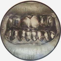 PUP (3) PUP VINYL LP