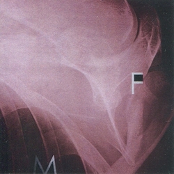 Father Murphy Pain Is On Our Side Now Vinyl 10"